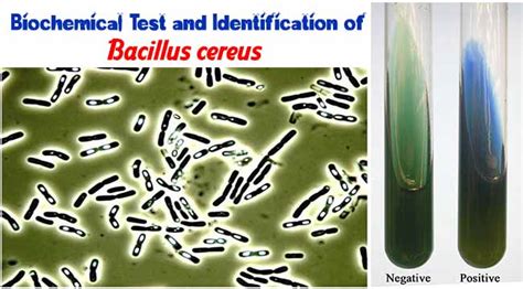 bacillus biochemical test|Spore Staining and Biochemical Characterization of Bacillus.